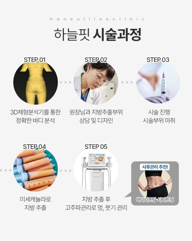 성수동 하늘라인의원의 지방추출주사 시술과정