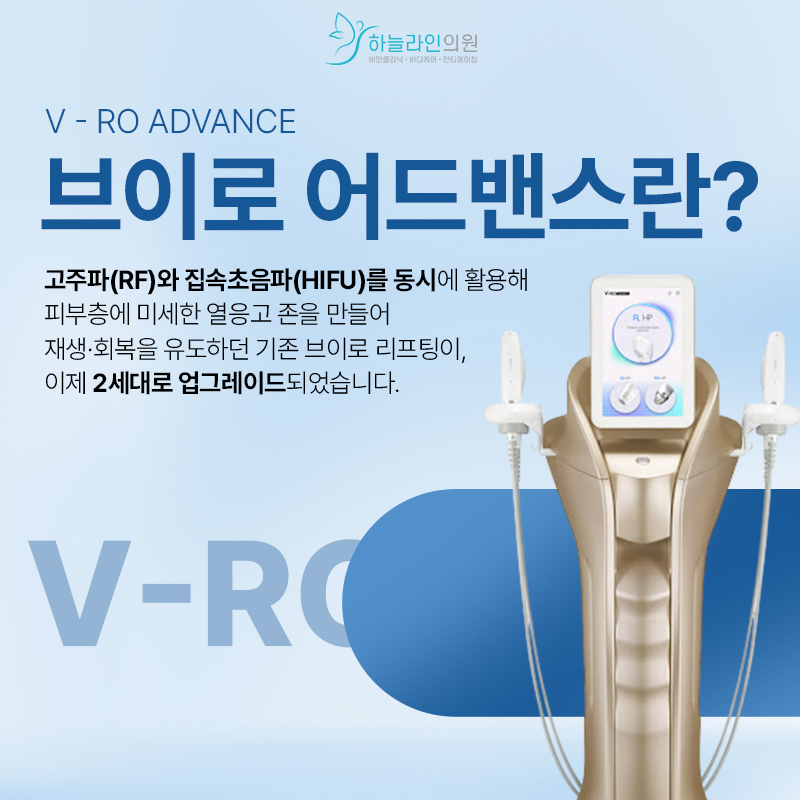 브이로 어드밴스