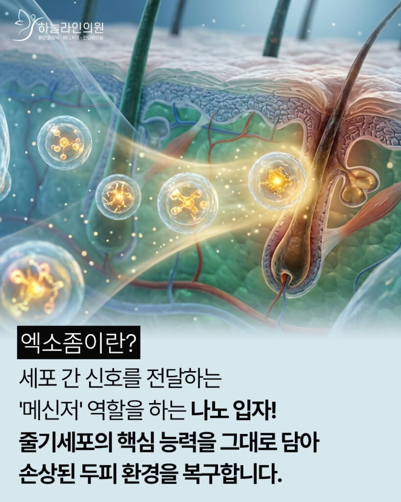 두피환경 복구를 위한 엑소좀