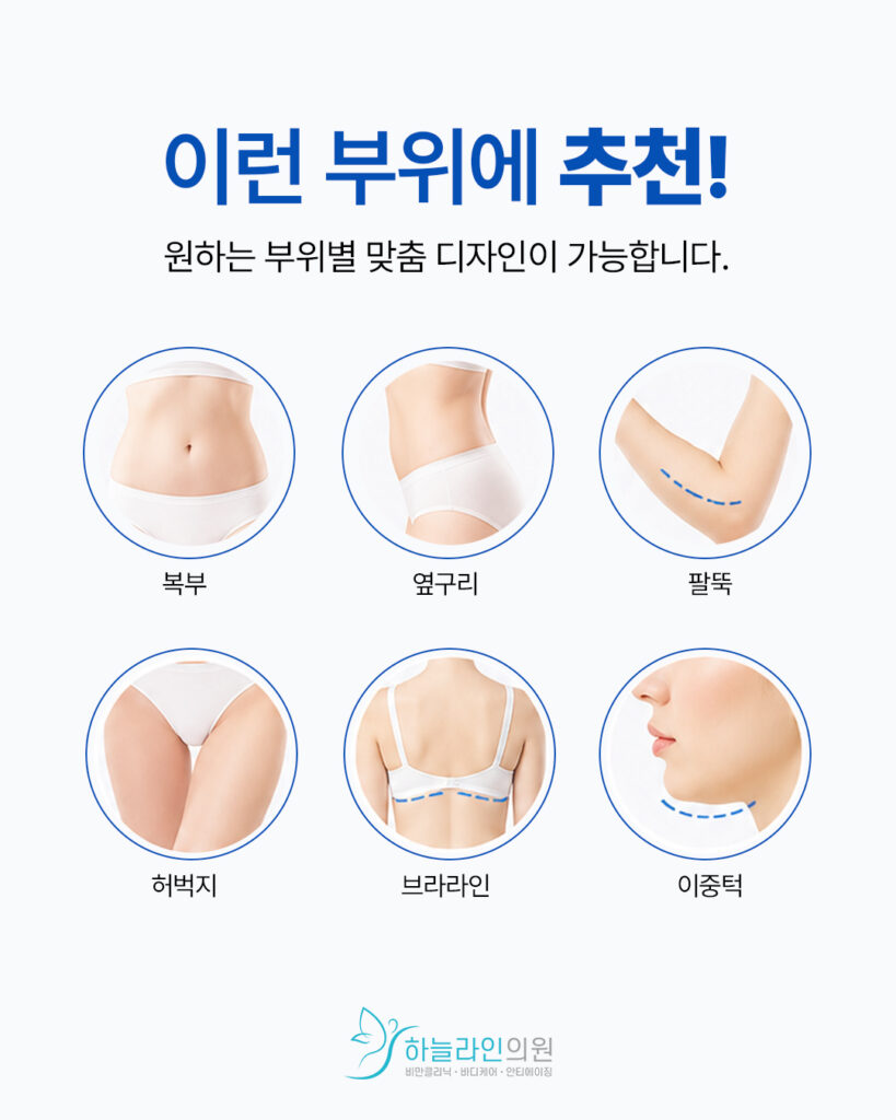 지방파괴주사 대상부위