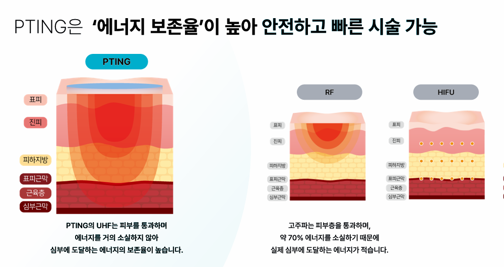 피팅리프팅