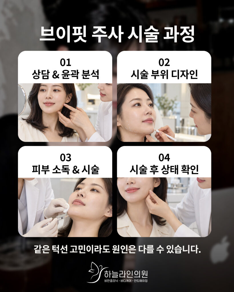 윤곽주사 브이핏 시술 과정
